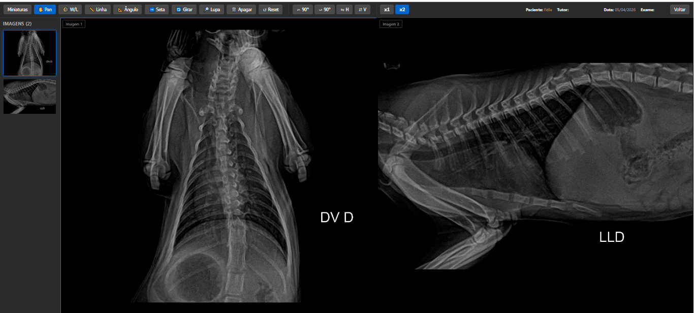 Visualizador DICOM